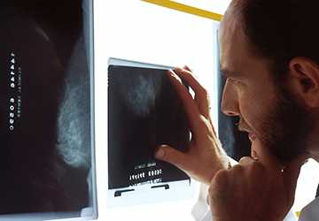 5 Essential Insights for Early Cancer Detection
