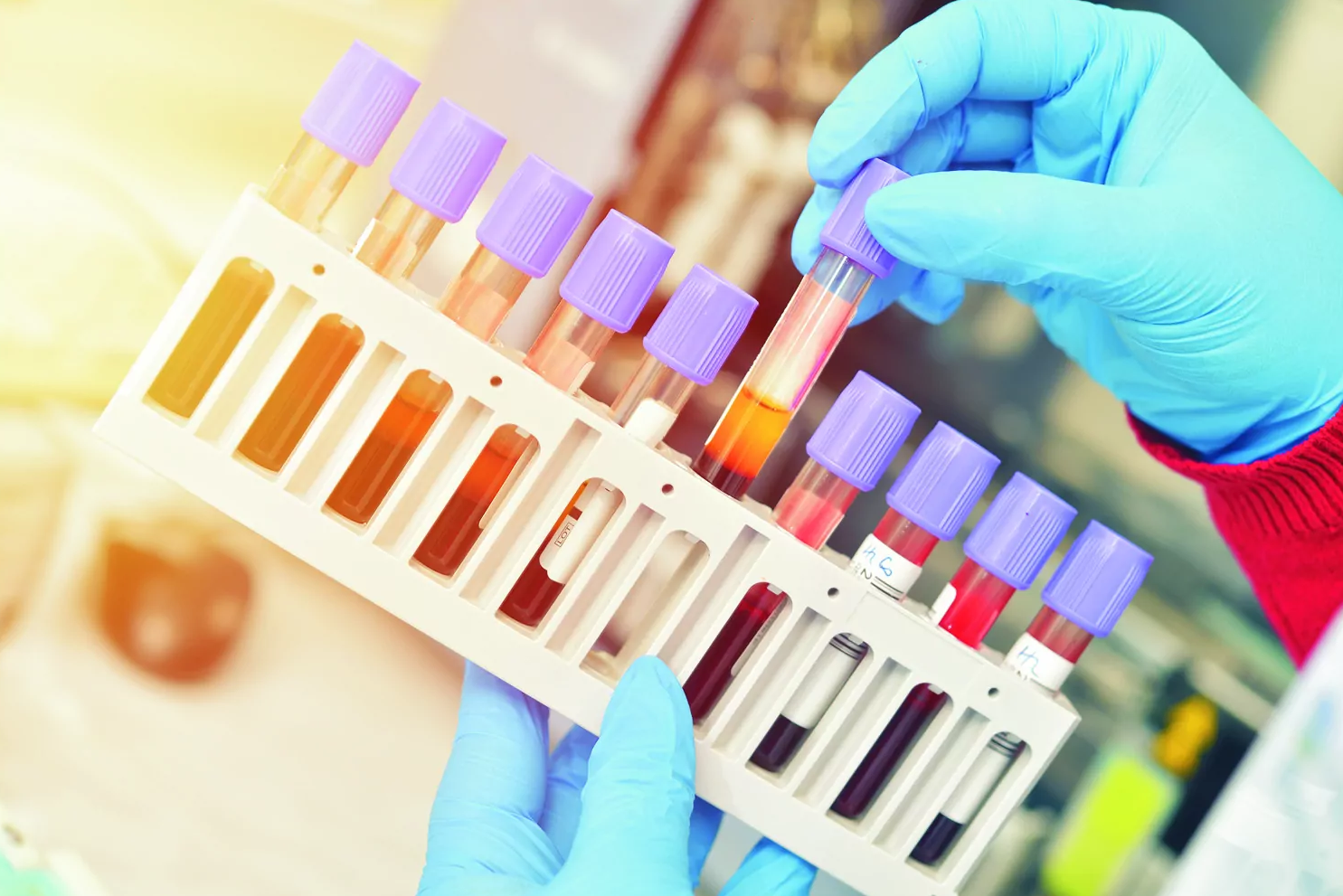 Understanding Metabolic Flux Analysis